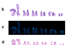 Mitotic chromosomes of Paradiplozoon homoion. (a) Spread mitotic metaphase stained by Giemsa. (b) Karyotype derived from the cell shown in Fig. 1a. (c) The same chromosome set counterstained by DAPI. (d) C-banded mitotic chromosomes. (e) Mitotic chromosomes stained by YOYO-1. Bar indicates 10 μm.